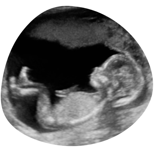 Ontwerp Zonder Titel 4