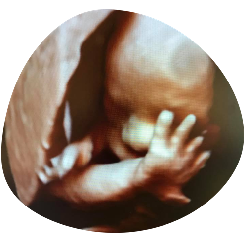 Ontwerp Zonder Titel 3